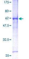 12.5% SDS-PAGE Stained with Coomassie Blue.